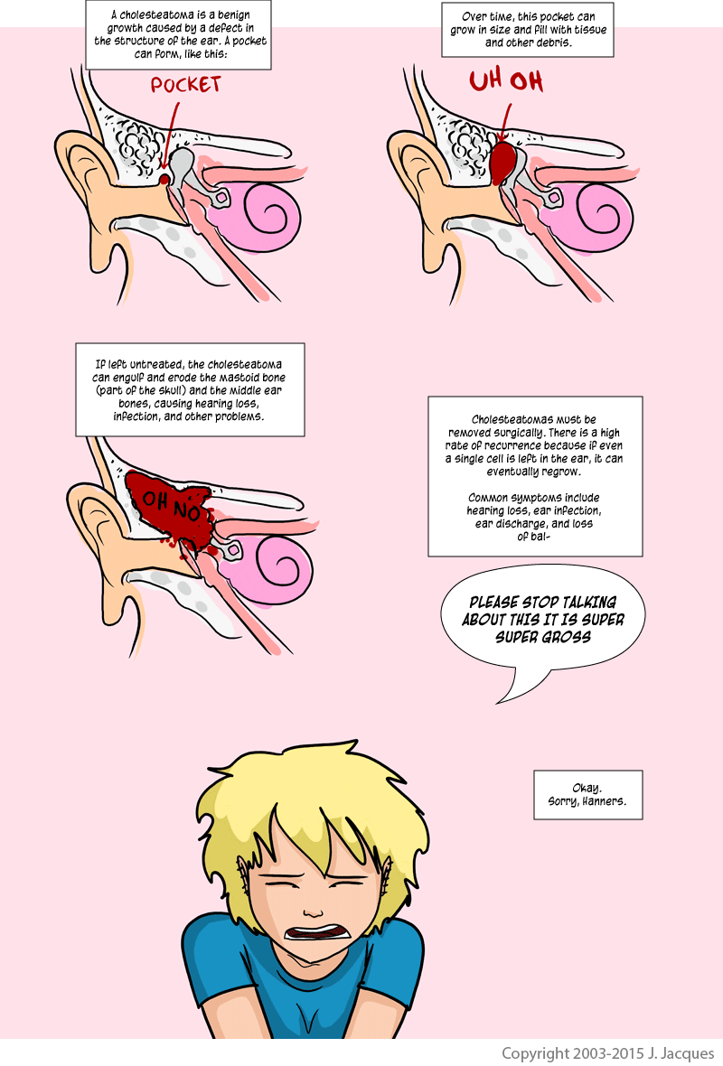 Cholesteatoma explained children